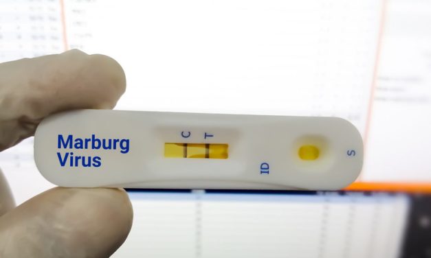 Learn more: Marburg Virus