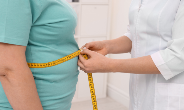 The rise of obesity in South Africa