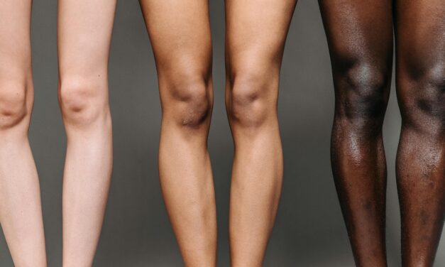 How weight affects your joints: understanding the impact