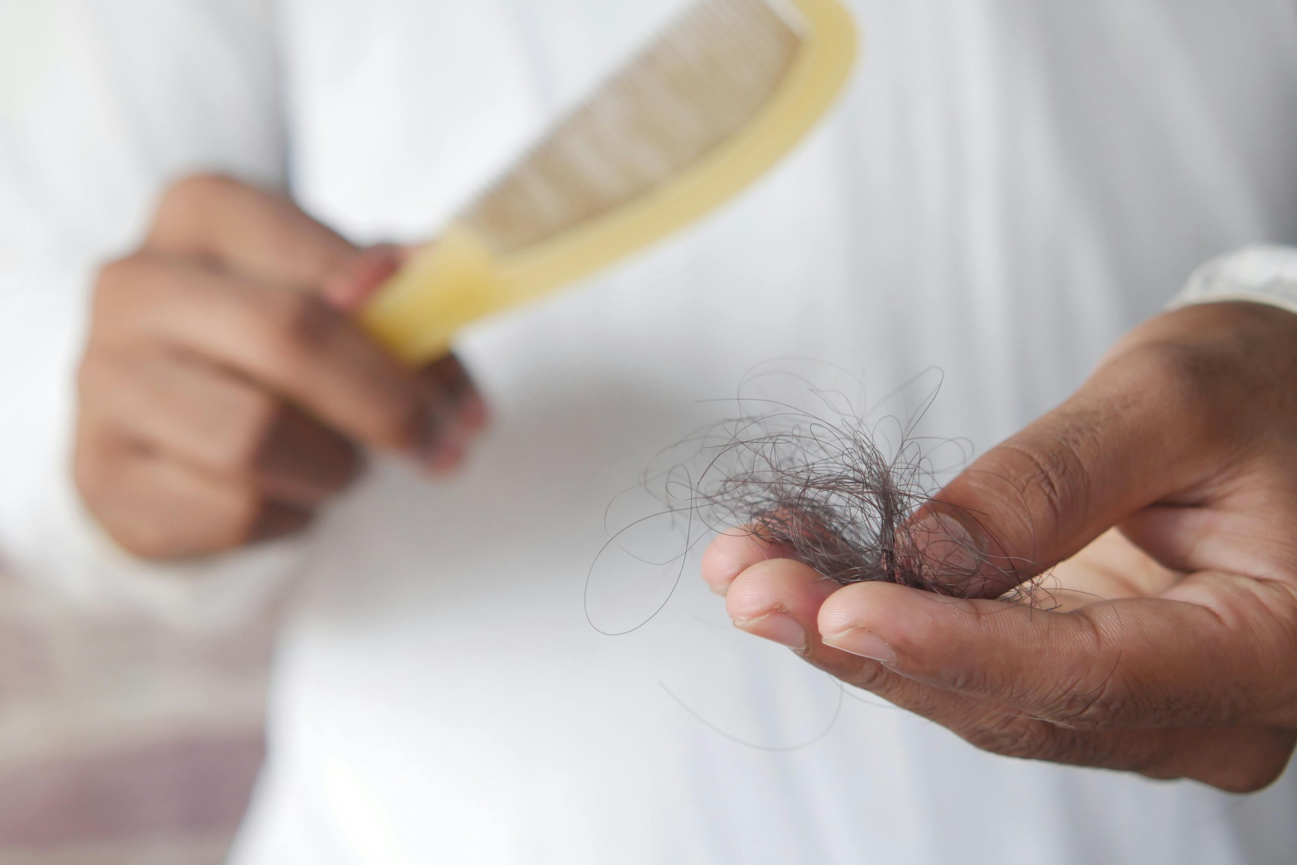 2 Male-pattern baldness hair follicles