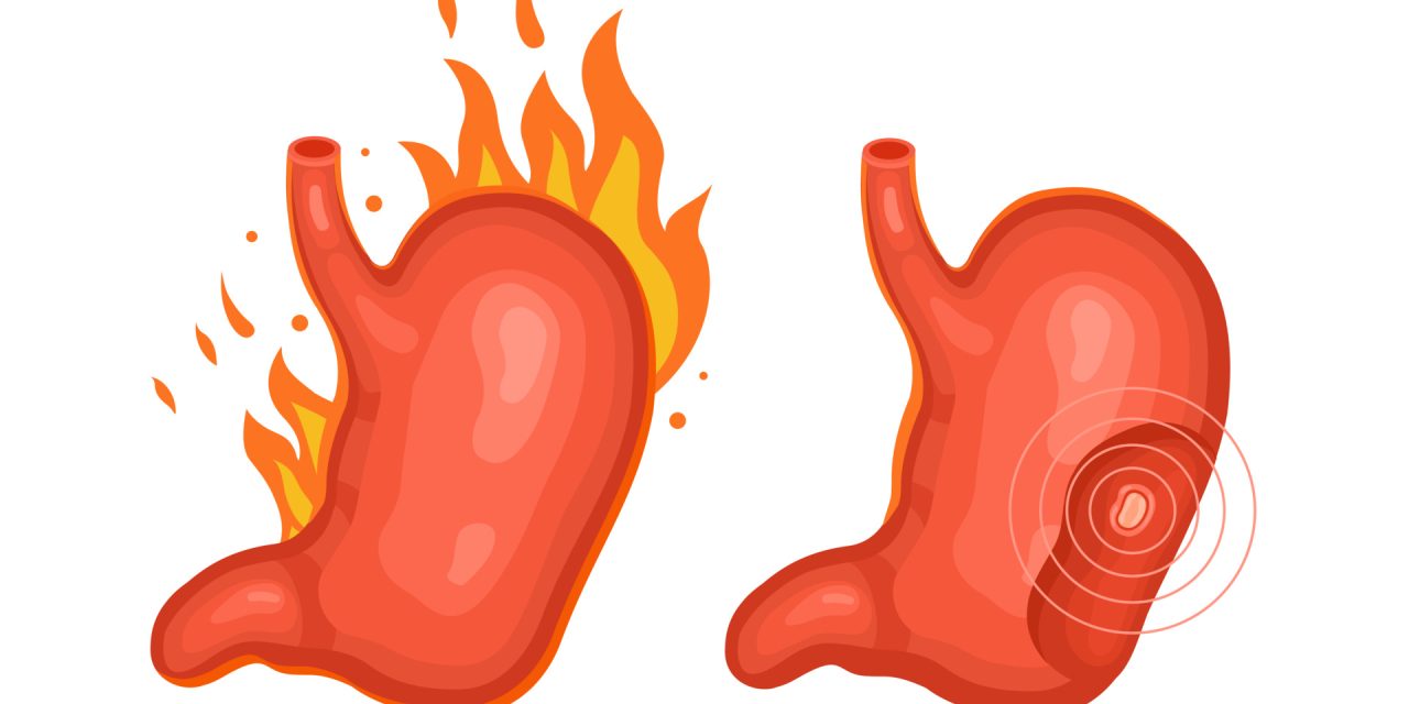 Stop heartburn from ruining your day: tips for fast relief
