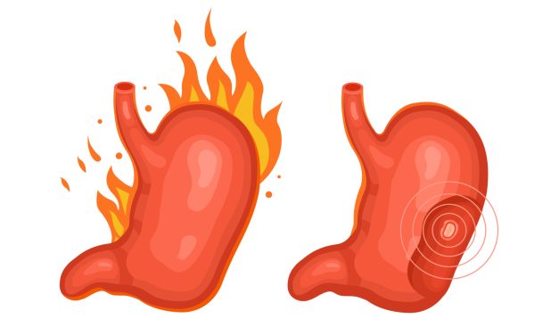 Stop heartburn from ruining your day: tips for fast relief