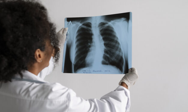 Testing for tuberculosis (TB)