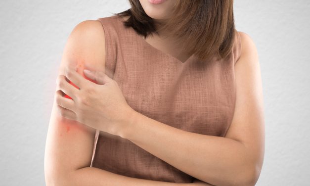 Simple solutions to manage chronic eczema
