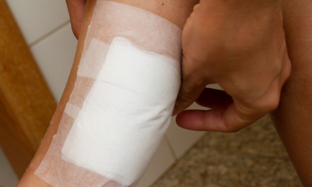 First aid for burns – quick tips for fast relief