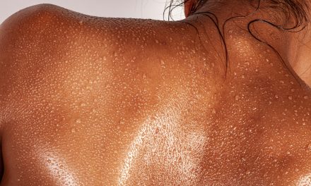 Protect your skin: understanding and preventing skin cancer