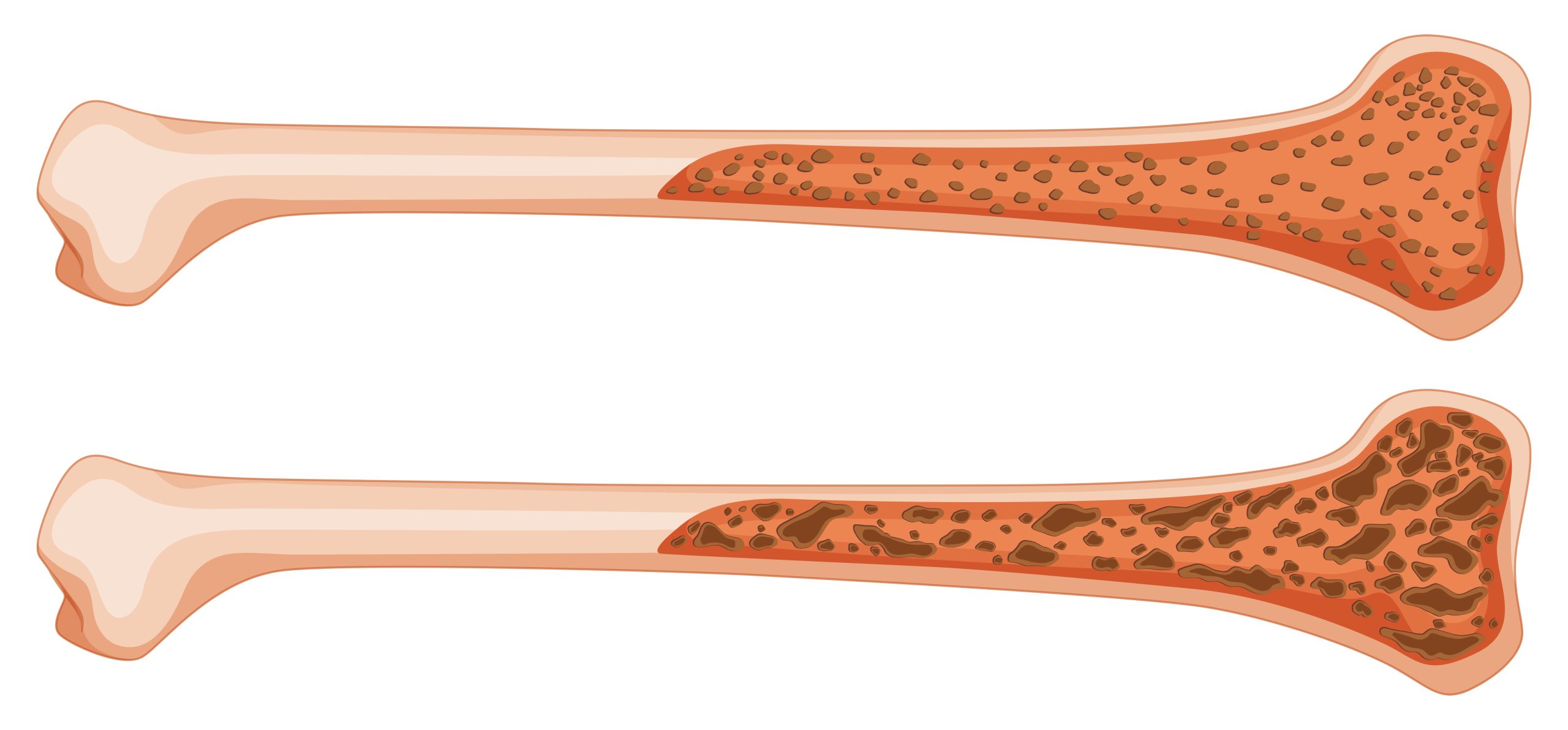 The importance of bone marrow
