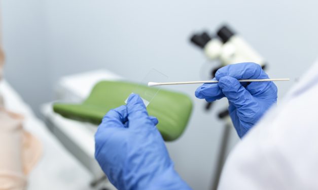 Why Pap smears matter: understanding your cervical cancer risk