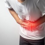 Ulcerative Colitis: 72-Hour Reset Plan