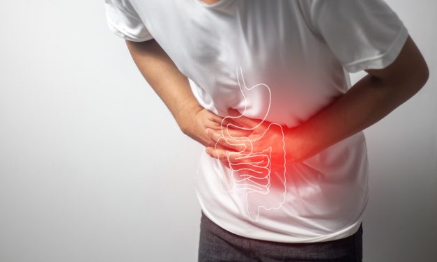 Ulcerative Colitis: 72-Hour Reset Plan